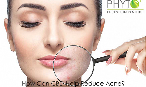 How can CBD help reduce acne?