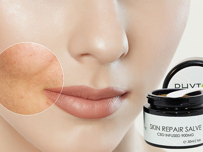 Phyto Plus® CBD Skin Repair Salve 900 mg pour les problèmes de peau à tendance acnéique