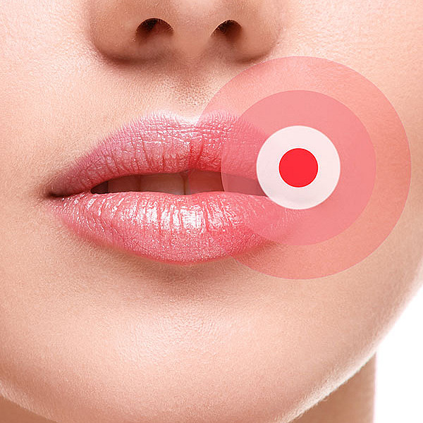 Baume à lèvres au CBD Bâton de Phyto Plus® pour l'hydratation des lèvres et les plaies