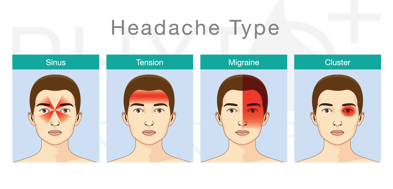 Verschillende soorten hoofdpijnen